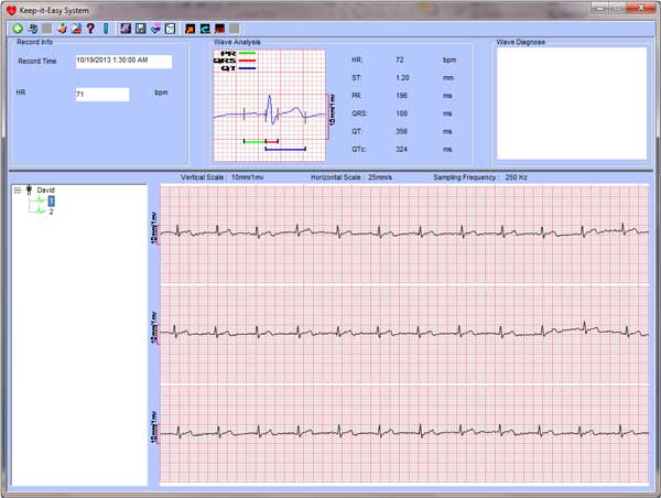 Ecg md100b software download free Ecg md100b software download free