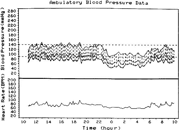 Low Systolic Blood Pressure Chart